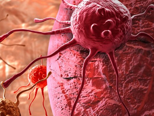 خوراکیهایی که خاصیت ضد سرطانی دارند خوراکیهایی که خاصیت ضد سرطانی دارند